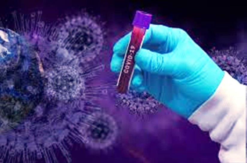 MT registra 890 casos a mais da Covid 19 e salta para 28.526 mil;  Mortos são 1.047 mil