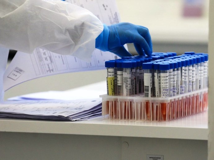 Mato Grosso tem 113.186 mil casos das Covid 19 e 3.279 mil mortes neste domingo, 20