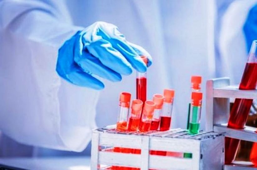 Mato Grosso tem nesta quinta feira, 23, 41.016 mil casos da Covid 19 e 1.498 mortes