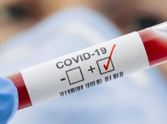 MT registra até sexta feira, 10, 554.463 mil casos da Covid 19 e 14.015 mil mortes