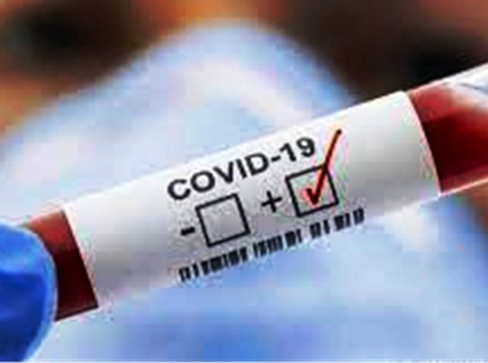MT registra 515.218 mil casos da Covid 19 e 13.397 nesta quarta feira, 25