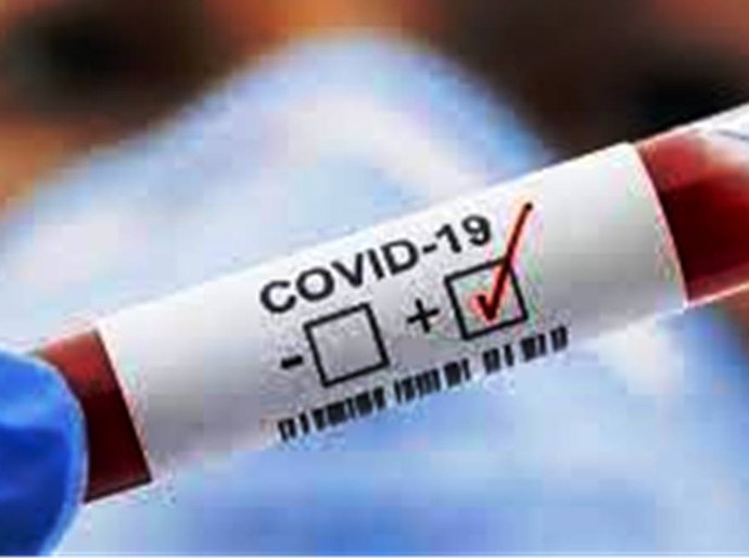 MT tem até domingo, 27, 448.308 mil casos da Covid 19 e 11.926 mil mortos