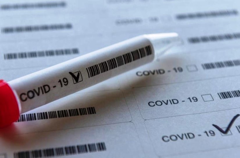 MT tem até domingo, 24, 208.088 mil casos da Covid 19 e 4.968 mil mortes
