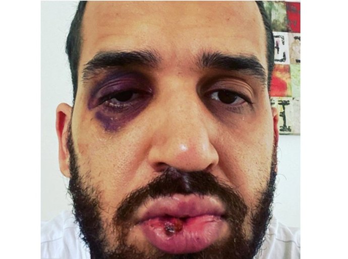 Médico é agredido por familiar após alertar sobre riscos da Covid-19, no Paraná: 'Dói, mas sinto que estou do lado que zela pela vida'