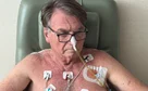 Bolsonaro tem gastroparesia e soluços; entenda quadro