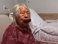 Cacique Raoni é diagnosticado com câncer aos 94 anos e recebe cuidados paliativos em MT