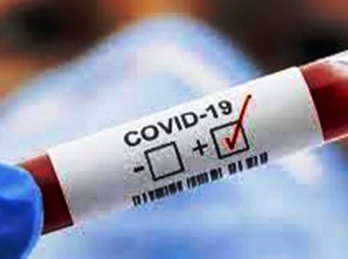 MT registra 464.174 mil casos da Covid 19 e 12.294 mil mortes até sábado, 10