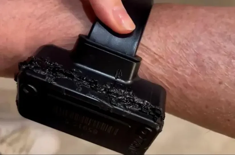 Bolsonaro diz que usou ferro de solda em tornozeleira: 'Curiosidade'