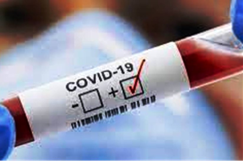 MT tem até quinta feira, 24, 445.690 mil casos da Covid 19 e 11.826 mil mortes