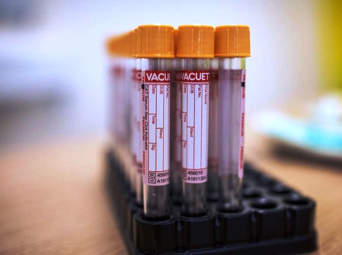 Covid-19: Brasil acumula 4,4 milhões de casos e 134,9 mil mortes