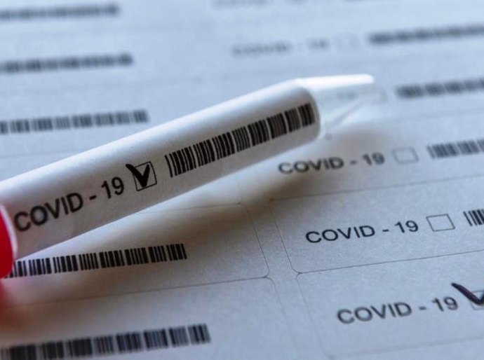 MT tem até domingo, 24, 208.088 mil casos da Covid 19 e 4.968 mil mortes