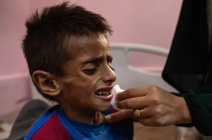 Gaza enfrenta 'pior cenário possível de fome', diz órgão de segurança alimentar ligado à ONU