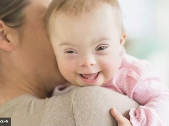 Como queda de nascimentos de bebês com Down virou pivô da disputa entre grupos pró e contra aborto na Europa