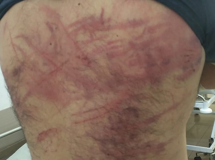 TERROR EM TANGARÁ: Falsos policiais invadem casa, torturam casal e são capturados após caçada policial fulminante