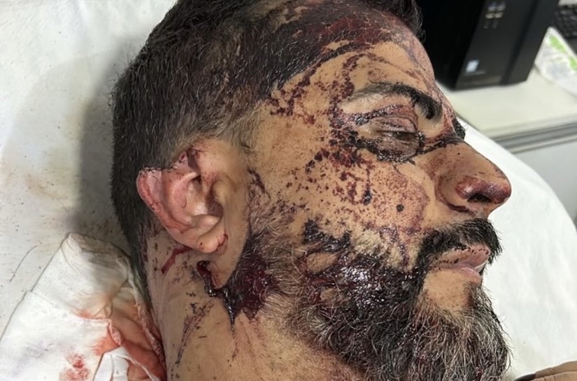 TERROR DENTRO DE CASA: criminosos exigem R$ 1 milhão, cortam orelha de vereador e ameaçam filho em Rondonópolis,MT