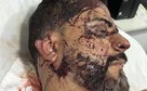 TERROR DENTRO DE CASA: criminosos exigem R$ 1 milhão, cortam orelha de vereador e ameaçam filho em Rondonópolis,MT