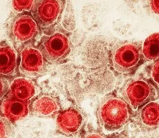 Vírus comuns podem aumentar o risco de Alzheimer?