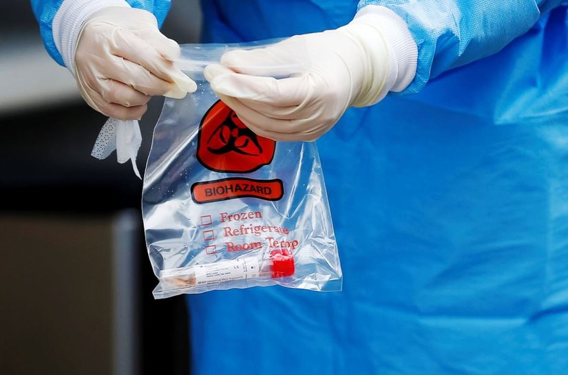 Covid-19: país tem 121,3 mil mortes e 3,9 milhões de casos acumulados