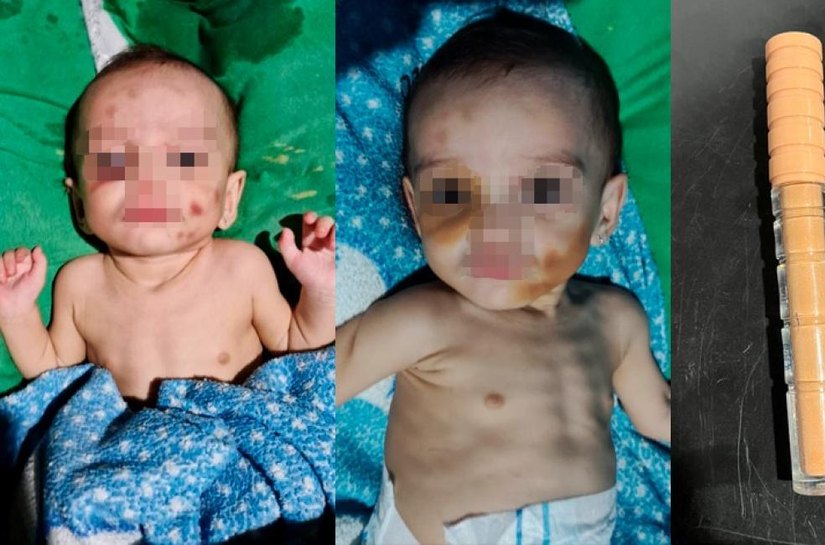 Polícia Civil indicia mãe por maus-tratos e abandono de filhos; bebê foi encontrada desnutrida e com hematomas