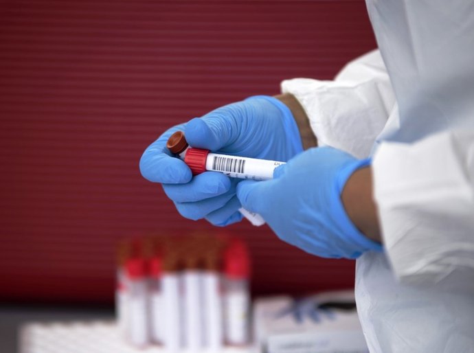 Mato Grosso tem 53.440 mil casos da Covid 19 e 1.902 mortes neste domingo, 02