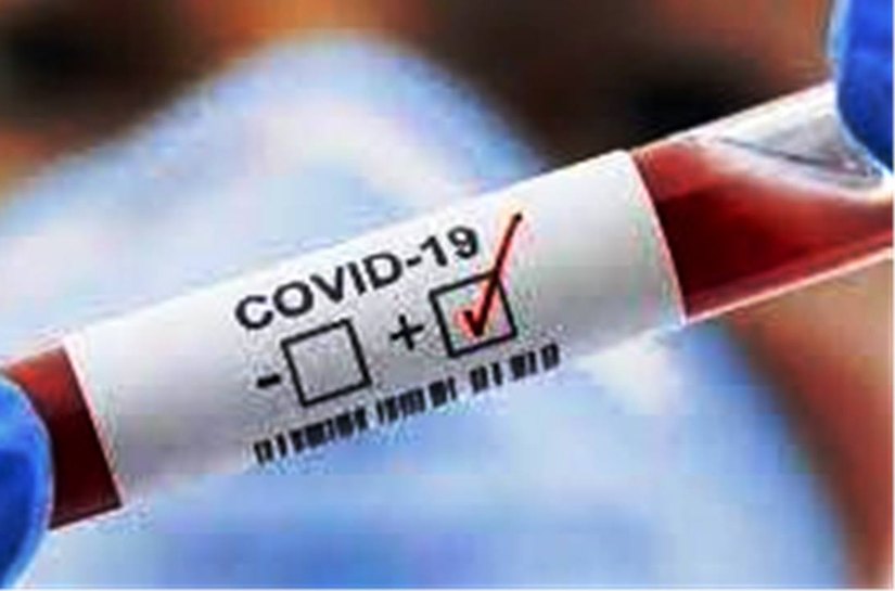 MT tem até domingo, 18, 342.896 mil casos da Covid 19 e  9.084 mil mortes