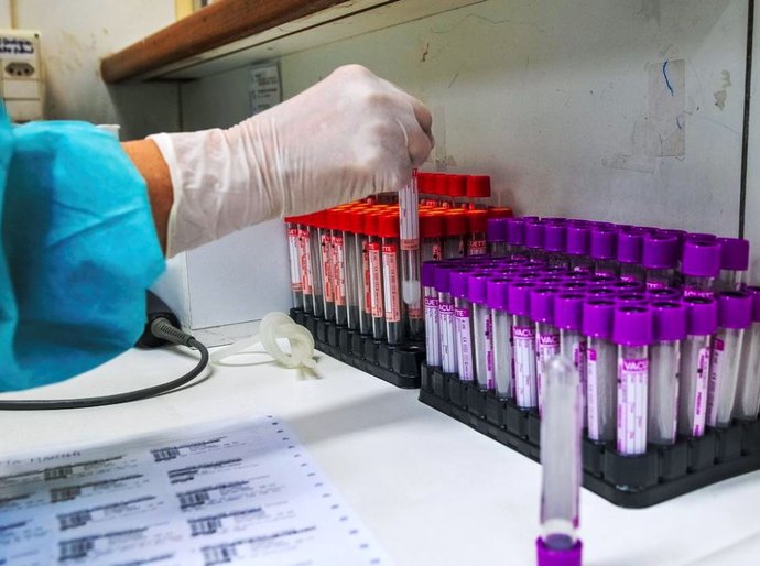 Covid-19: UFRJ desenvolve teste sorológico 20 vezes mais barato