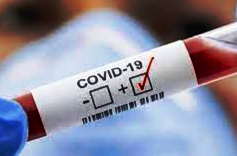 MT registra 464.174 mil casos da Covid 19 e 12.294 mil mortes até sábado, 10