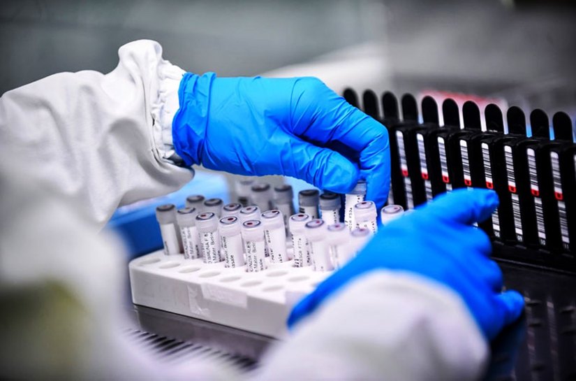 MT registra até segunda feira, 11, 191.106 mil casos da Covid 19 e 4.694 mil mortes
