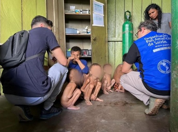 Hospital infantil de RR registra 29 internações de Yanomami em uma semana; número chega a 47