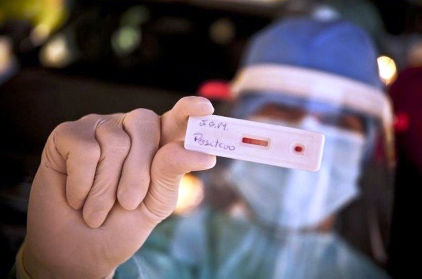 Mato Grosso tem 139.801 mil casos da Covid 19 e 3.773 mil mortes nesta sexta feira, 23