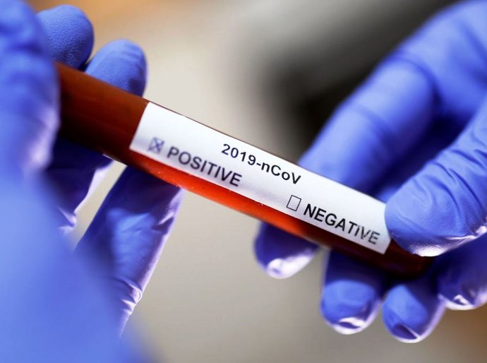 Covid-19: Brasil tem 123,7 mil mortes e 3,99 milhões de casos