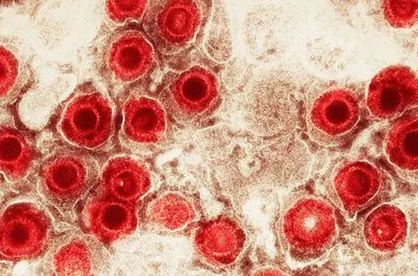 Vírus comuns podem aumentar o risco de Alzheimer?
