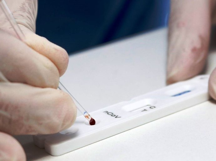 Mato Grosso registra 72.141 mil casos da Covid 19 e 2.336 mil mortes nesta sexta feira, 14                                       por Covid-19