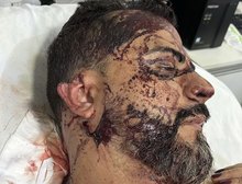 TERROR DENTRO DE CASA: criminosos exigem R$ 1 milhão, cortam orelha de vereador e ameaçam filho em Rondonópolis,MT