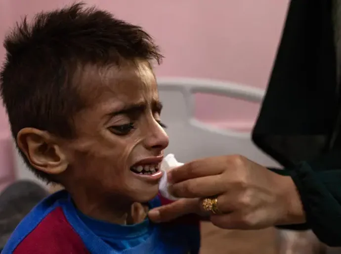 Gaza enfrenta 'pior cenário possível de fome', diz órgão de segurança alimentar ligado à ONU