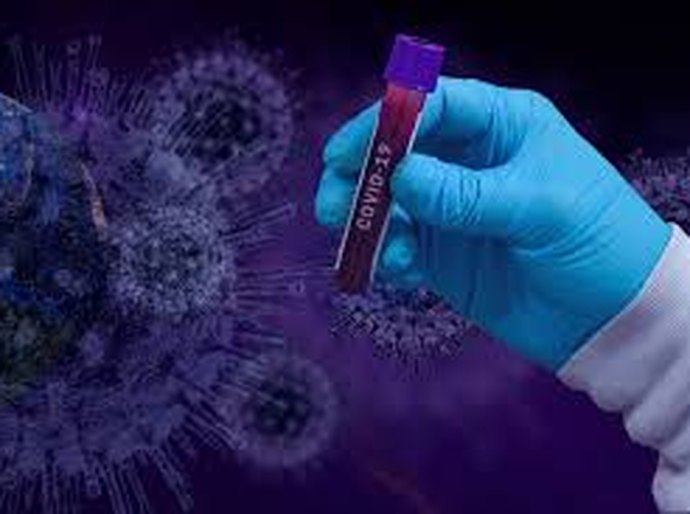 MT tem 81.469 mil casos e 2.558 mil mortes pela Covid-19 no sábado, 22