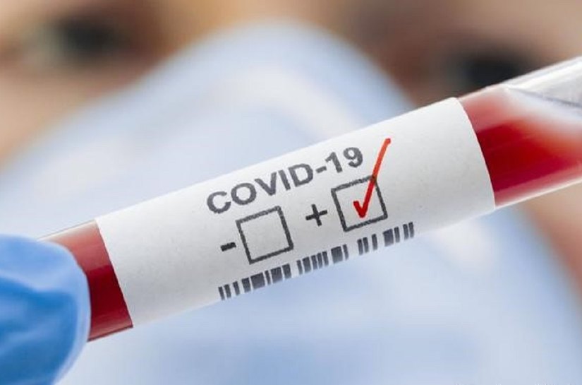 MT registra até sexta feira, 10, 554.463 mil casos da Covid 19 e 14.015 mil mortes