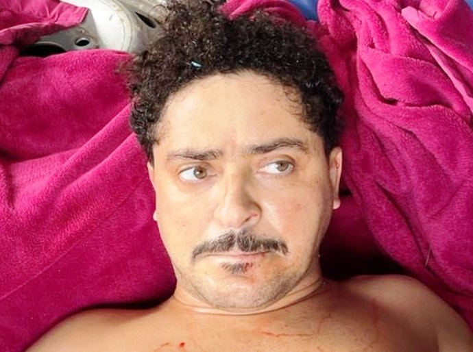 Ecko, chefe da maior milícia do Rio de Janeiro, morre após ser baleado pela polícia