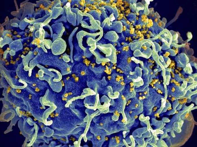 Variante do HIV mais transmissível e agressiva é encontrada na Holanda