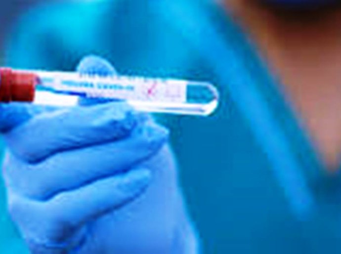 Mato Grosso tem 156.937 mil casos e 4.111 mil mortes nesta quarta feira, 25