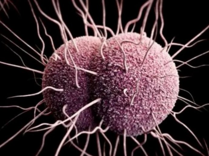 EUA registram primeiros casos de gonorreia resistente a antibióticos
