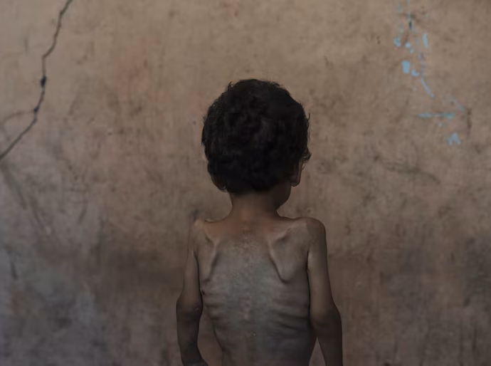 Gaza está morrendo de fome: 'Por que eles estão nos matando de fome?'