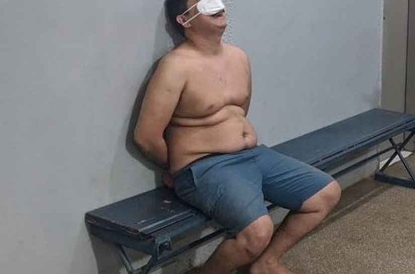 Drogado e embriagado, médico de 28 é preso após colidir seu veículo Corolla contra muro em VG