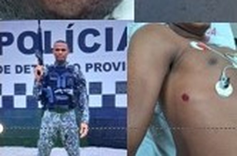 Policiais Militares e Penal trocam tiros durante abordagem a carro roubado em Cuiabá; um é ferido de raspão na cabeça