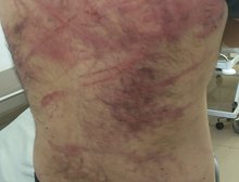 TERROR EM TANGARÁ: Falsos policiais invadem casa, torturam casal e são capturados após caçada policial fulminante