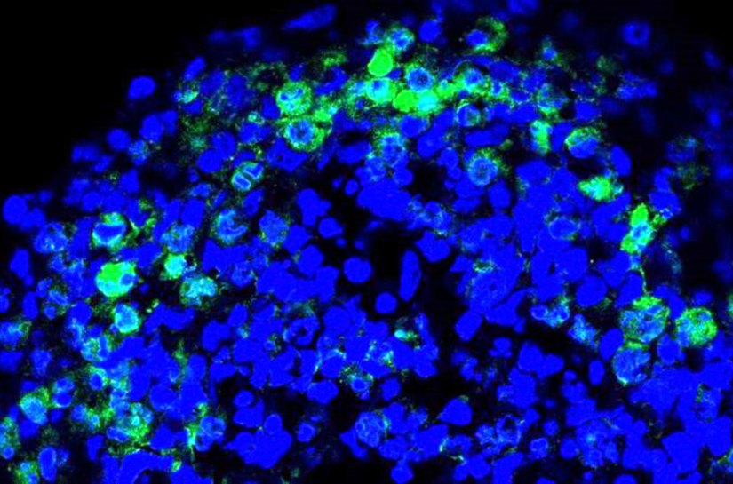 Cientistas criam miniórgãos e revolucionam o conhecimento sobre a covid-19