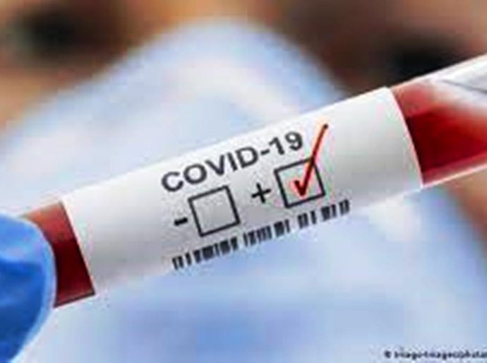 MT registra até quinta feira, 08, 324.899 mil casos da Covid 19 e 8.403 mil mortos