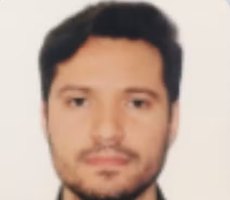 SONHO DA PLÁSTICA VIROU PESADELO: MÉDICO É INDICIADO POR DEFORMIDADES PERMANENTES EM MULHERES E ENTRA NA MIRA DO CRM EM MT