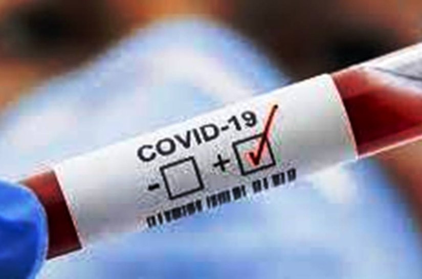 MT tem até sábado, 27, 301.454 mil casos da Covid 19 e 7.305 mil mortes