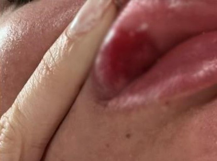 Noite de violência: estudante de Odontologia é espancada e humilhada por três mulheres em festa em Nossa Senhora do Livramento